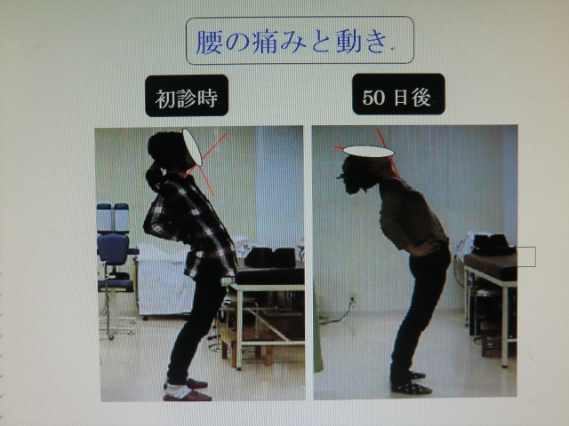 腰部動作の比較