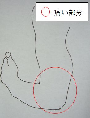 ひじ